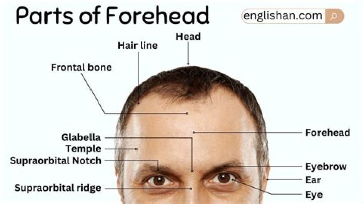 What does L on forehead mean