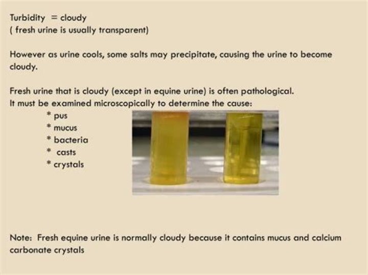What does MSU in urine mean