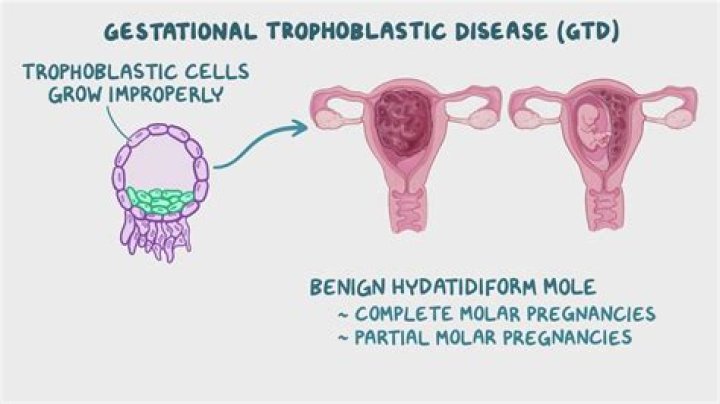 What does trophoblastic mean