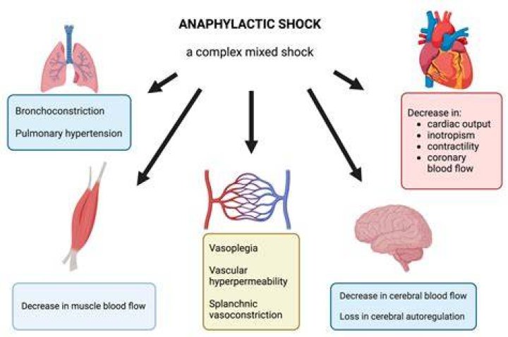 What is a anaphylactic shock