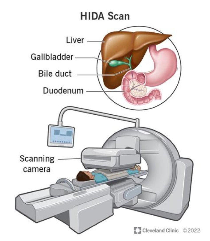 What is a hepatobiliary scan