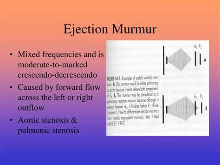 What is a systolic ejection murmur