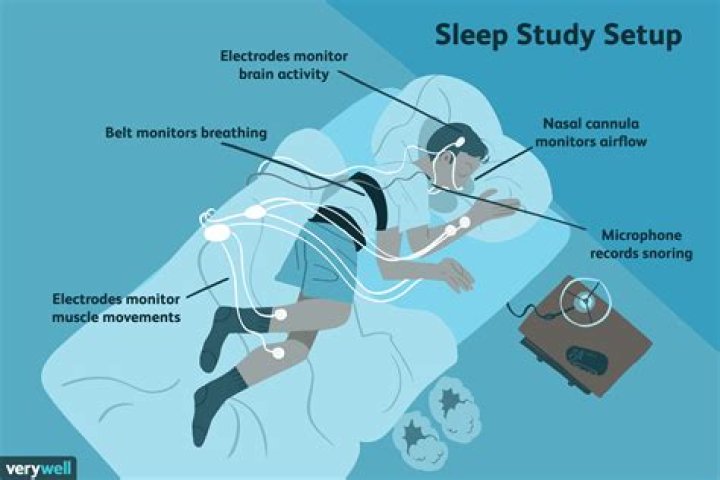 What is a Type 1 sleep study