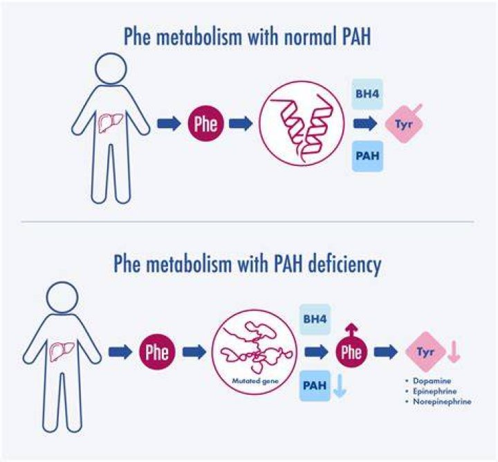 What is another name for PKU