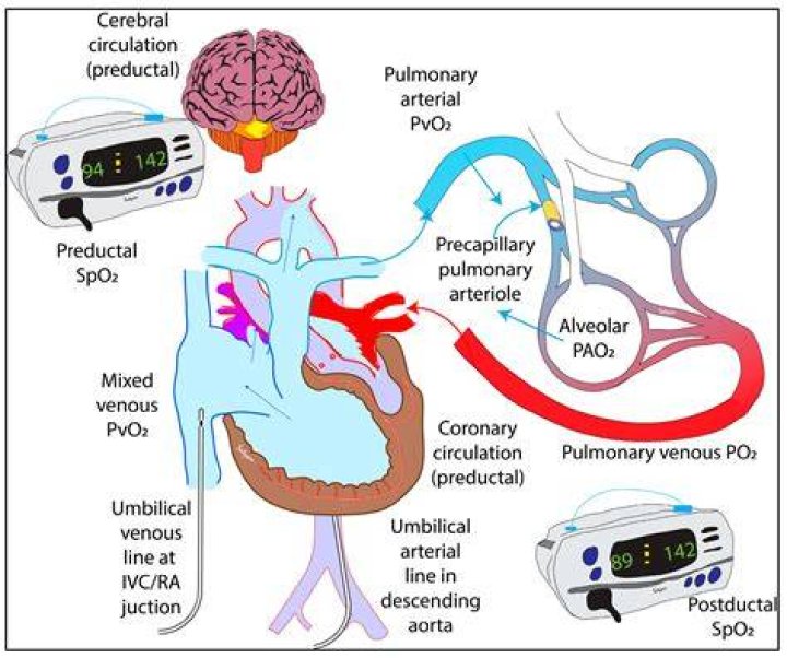 What is arterial oxygenation