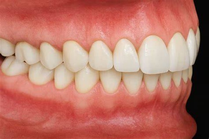 What is cold front occlusion