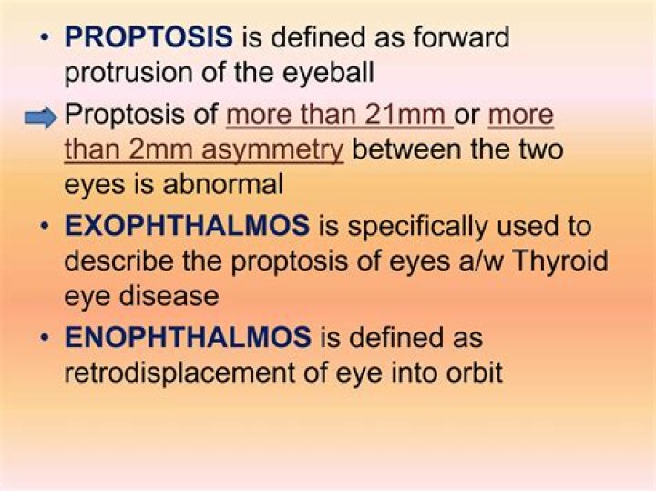 What is considered proptosis