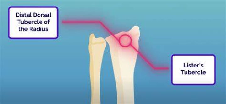 What is Listers tubercle