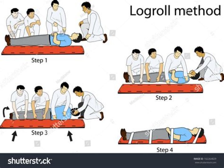 What is logrolling a patient