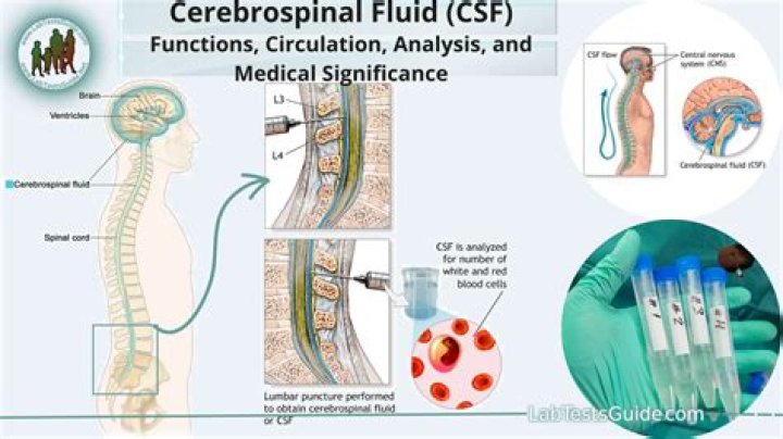 What is opening pressure CSF