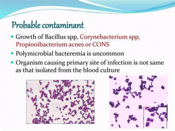 What is Polymicrobial growth