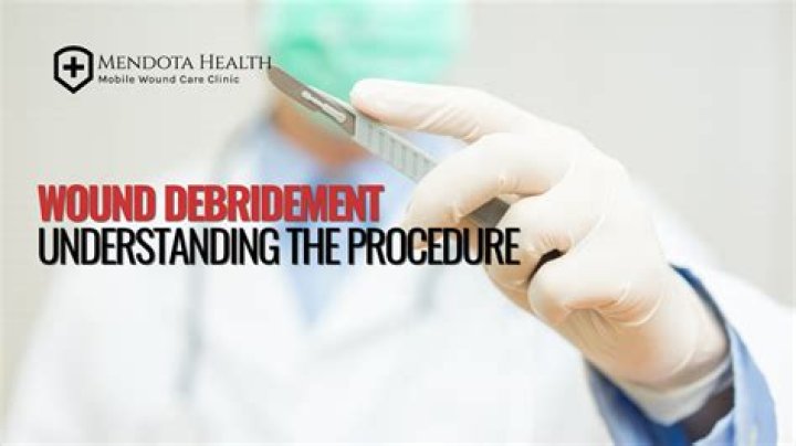 What is shoulder debridement