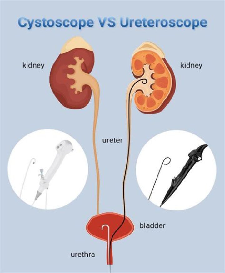 What is the difference between cystoscopy and ureteroscopy