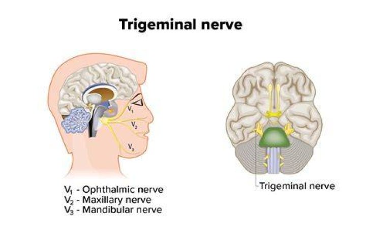 What is trigeminal dysphoria