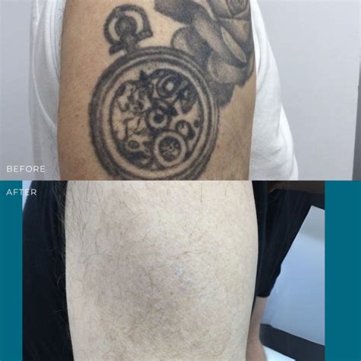What is Triss second tattoo