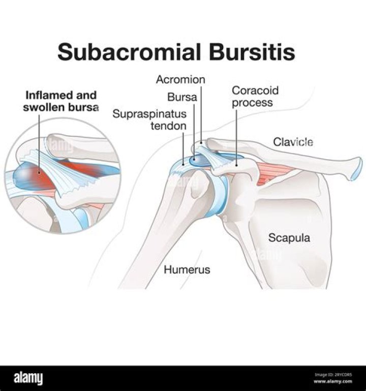 What joint is often associated with bursae