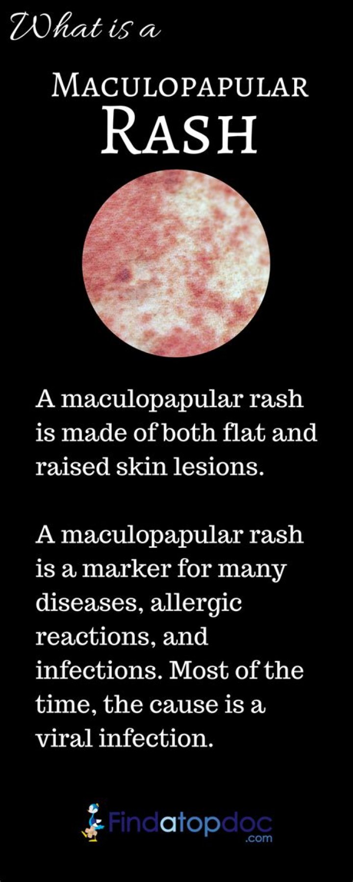 Whats a maculopapular rash