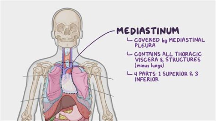 Where is mediastinal located