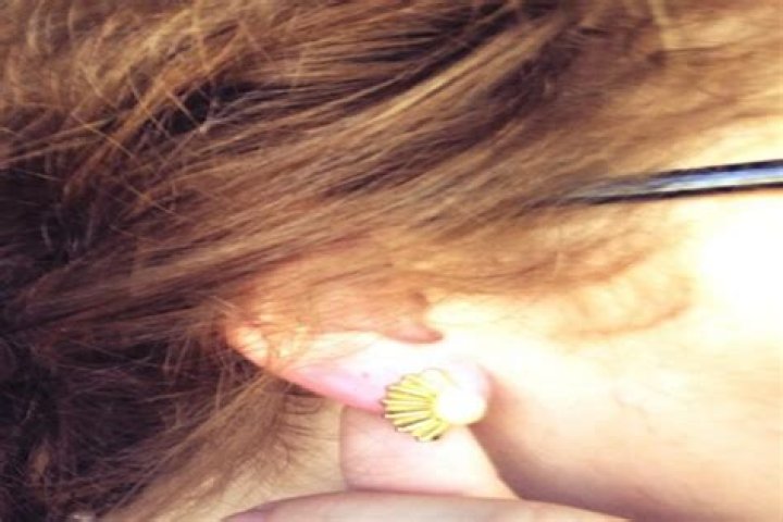 Why do clip on earrings hurt
