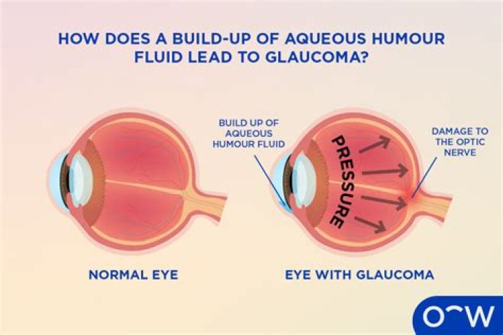Why do we need aqueous humor