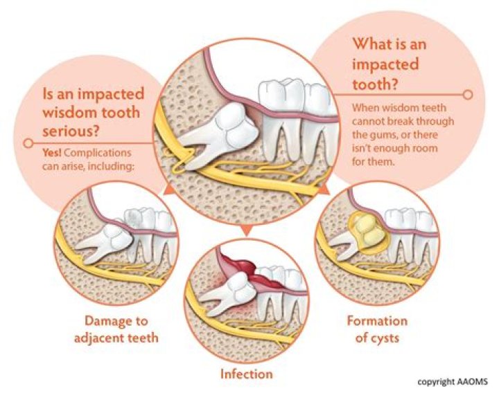 Why is it called enucleation