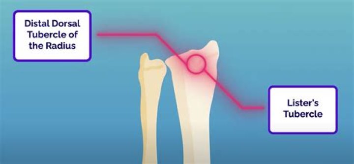 Why is Listers tubercle important